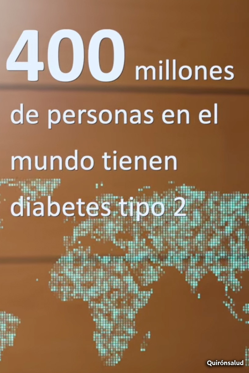 Casi un 30% de las personas no saben que tienen diabetes